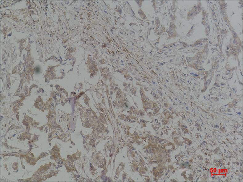 STAT1 Polyclonal Antibody (F241)