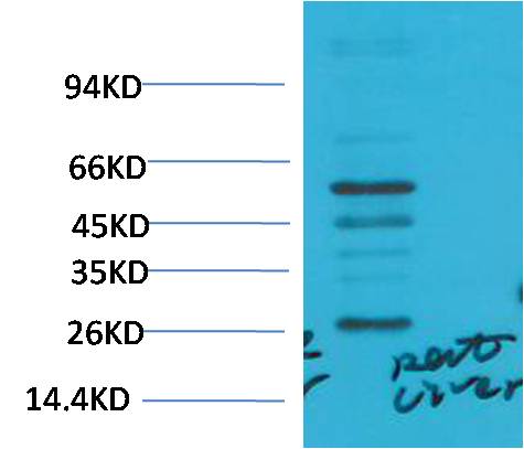 TGFBeta1 Polyclonal Antibody (TGF)