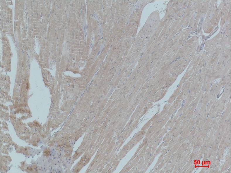 PPAR Gamma Polyclonal Antibody (F226)