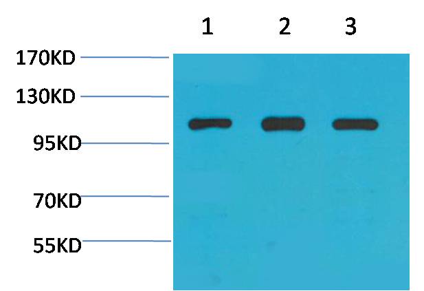 Alpha-actinin Polyclonal Antibody (F298)