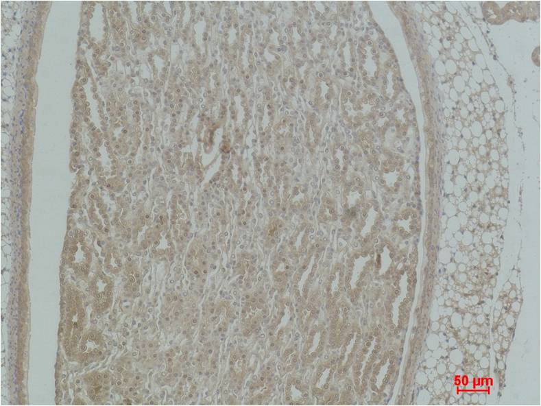 Alpha-actinin Polyclonal Antibody (F298)