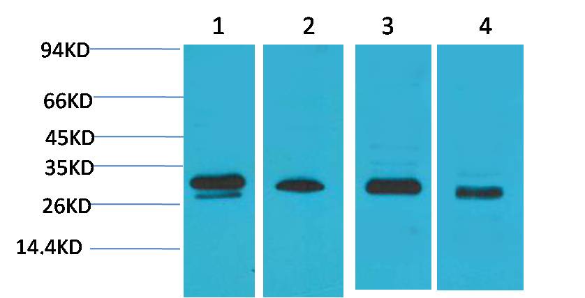 AMPKBeta2 Polyclonal Antibody (F110)