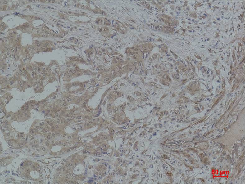 STAT3 Polyclonal Antibody (F246)