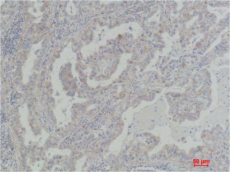 Akt2 Polyclonal Antibody (F204)
