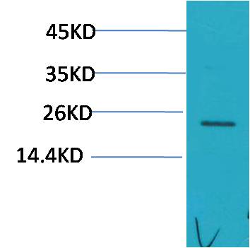 HSPB8 HSP22 Polyclonal Antibody (F167)