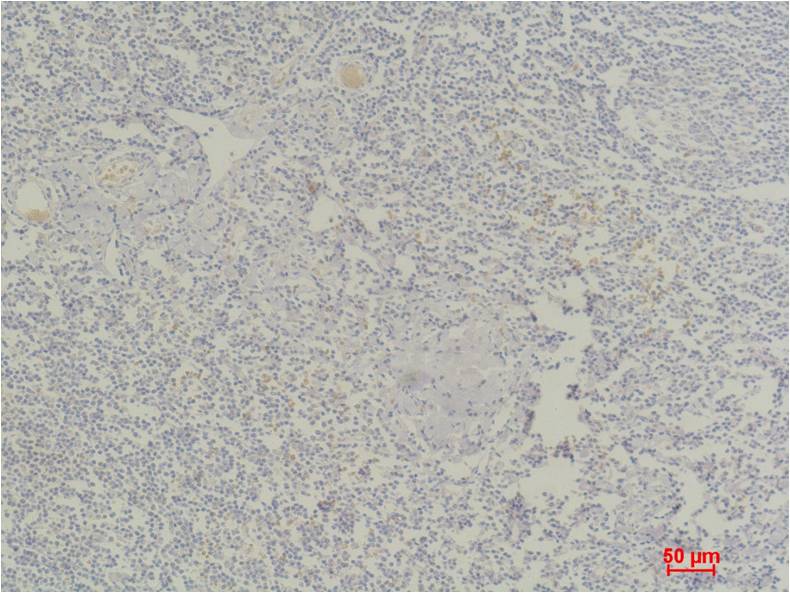 STAT4 Polyclonal Antibody (F248)