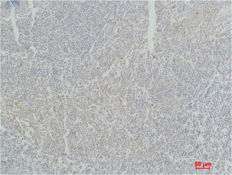 STAT4 Polyclonal Antibody (F250)