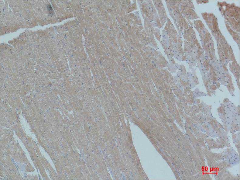 Smad2 Polyclonal Antibody (F231)
