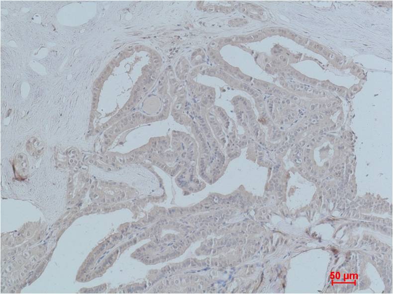 STAT2 Polyclonal Antibody (F244-1)