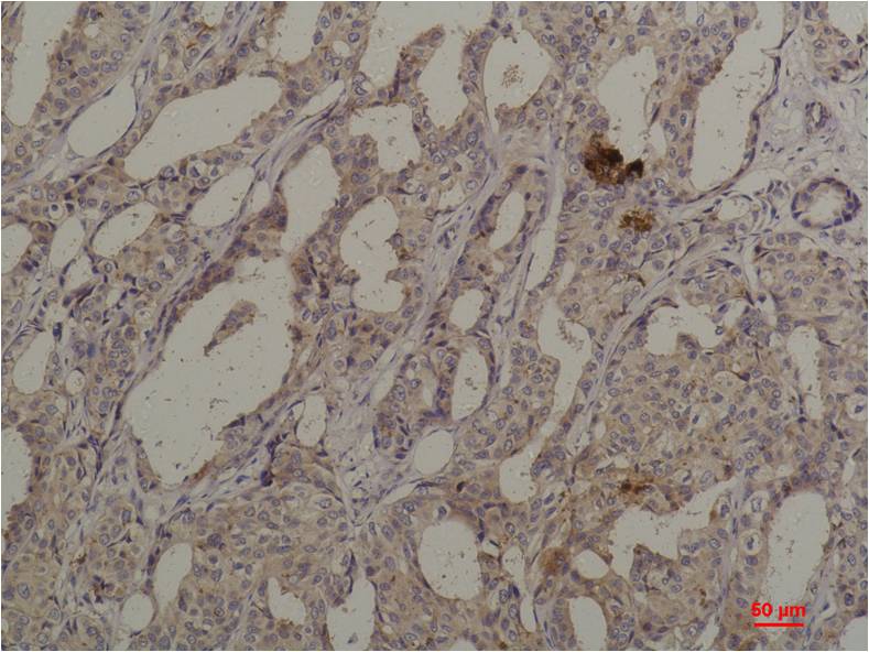 Akt1 Polyclonal Antibody (F201)