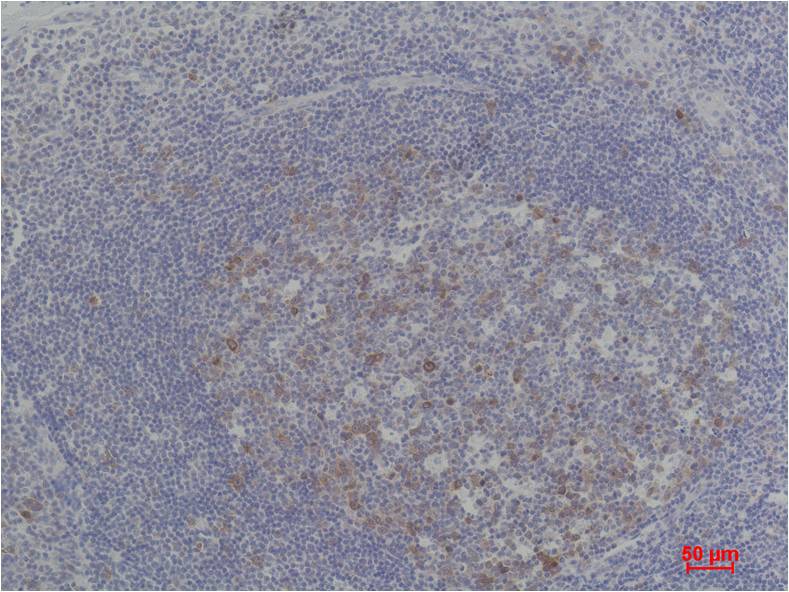 Cyclin B1 Polyclonal Antibody (F276)