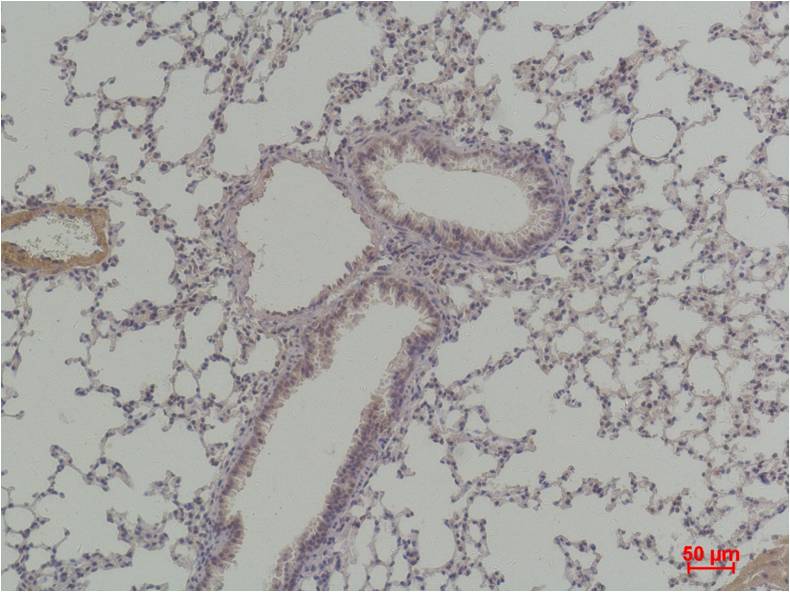 Cyclin D1 Polyclonal Antibody (F279)