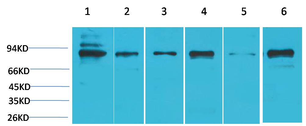 STAT5b Polyclonal Antibody (F255)