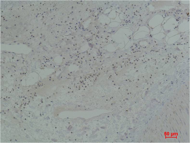 STAT5b Polyclonal Antibody (F255)