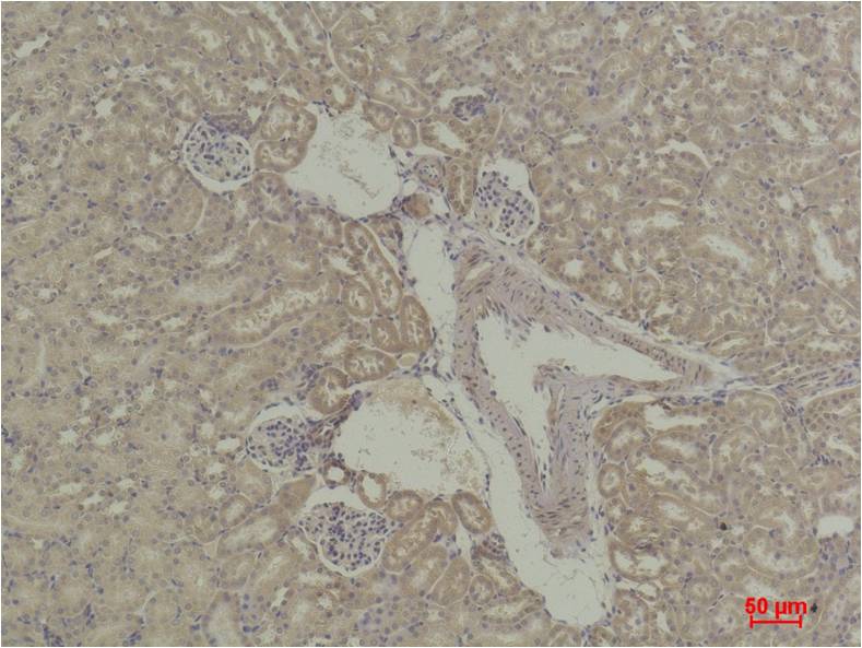 STAT5a Polyclonal Antibody (F251)