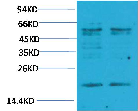 TNF Alpha Polyclonal Antibody (F261)