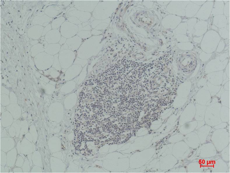 TNF Alpha Polyclonal Antibody (F262)