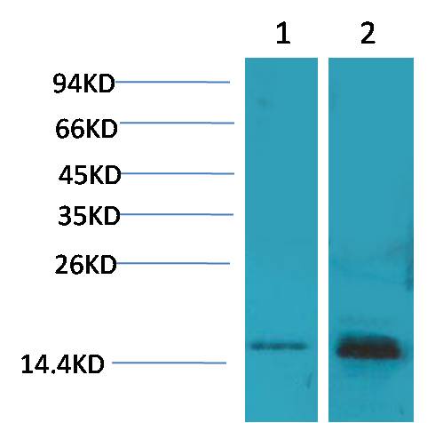 S100 Polyclonal Antibody (F229)