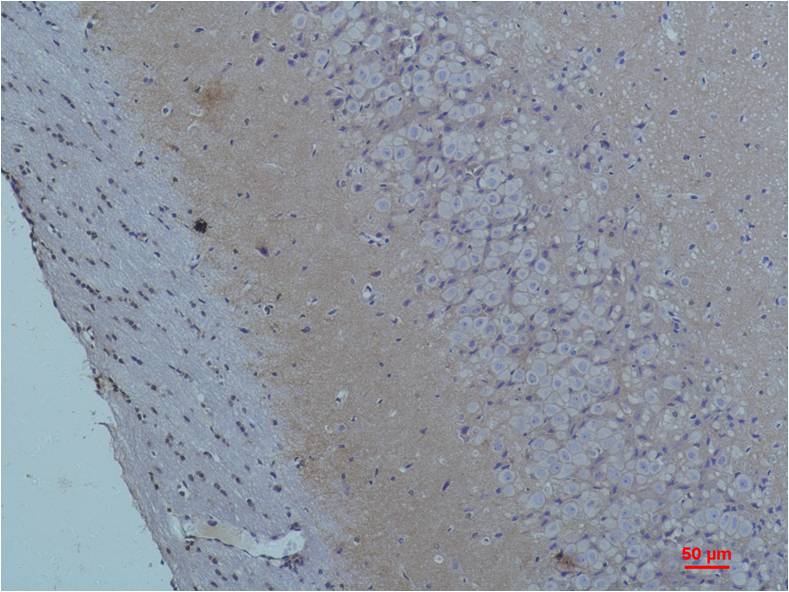 S100 Polyclonal Antibody (F229)