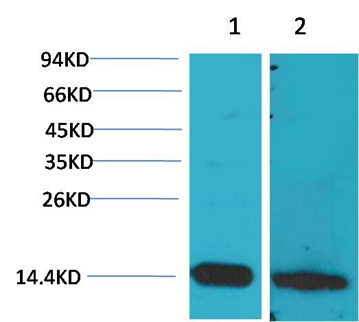 S100 Beta Polyclonal Antibody (F230)