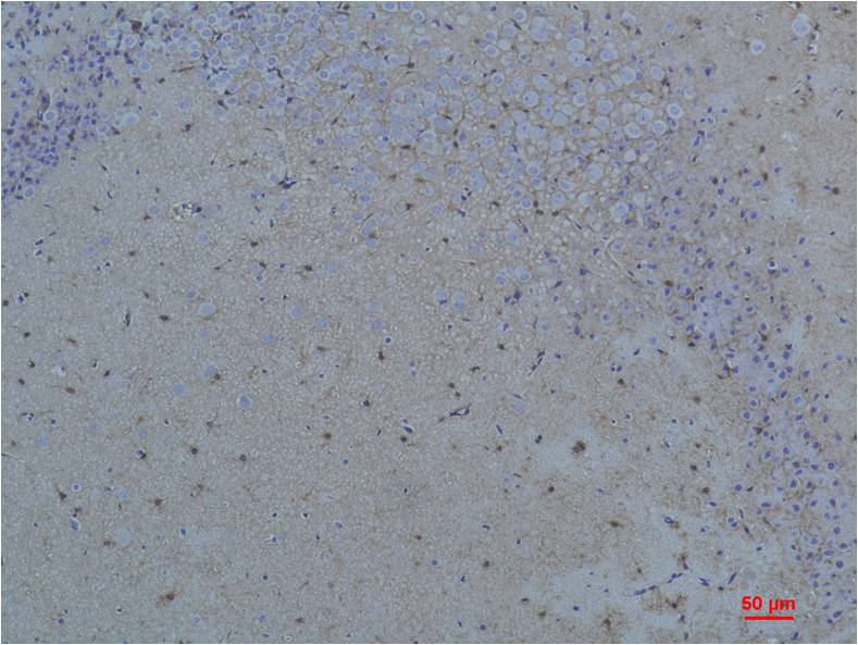 S100 Beta Polyclonal Antibody (F230)