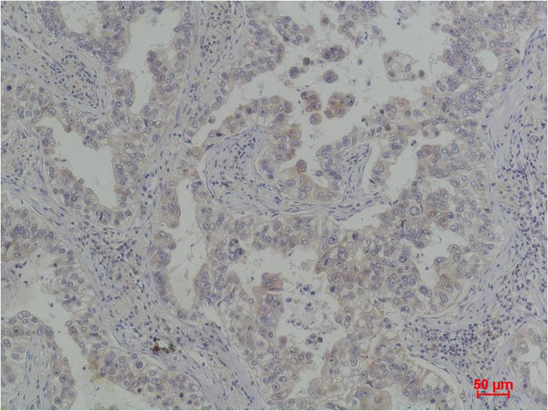 Bcl-Xl Polyclonal Antibody (F267)