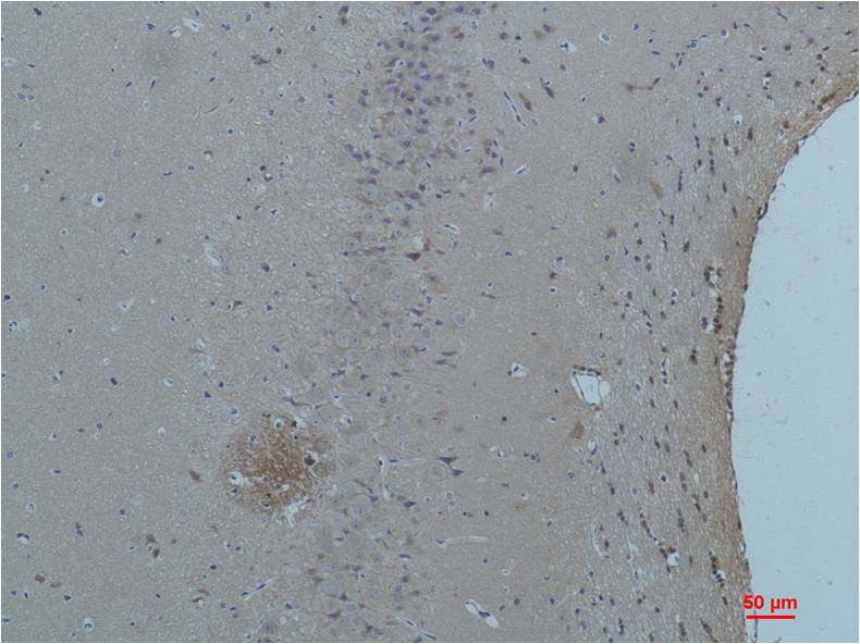 ASIC1 Polyclonal Antibody (A180)