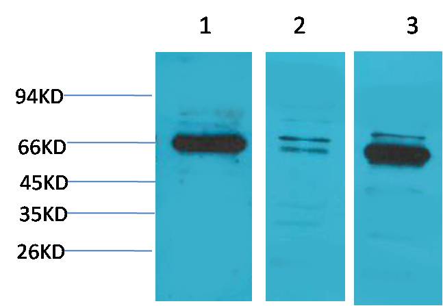 Bestrophin-1 Polyclonal Antibody (A184)