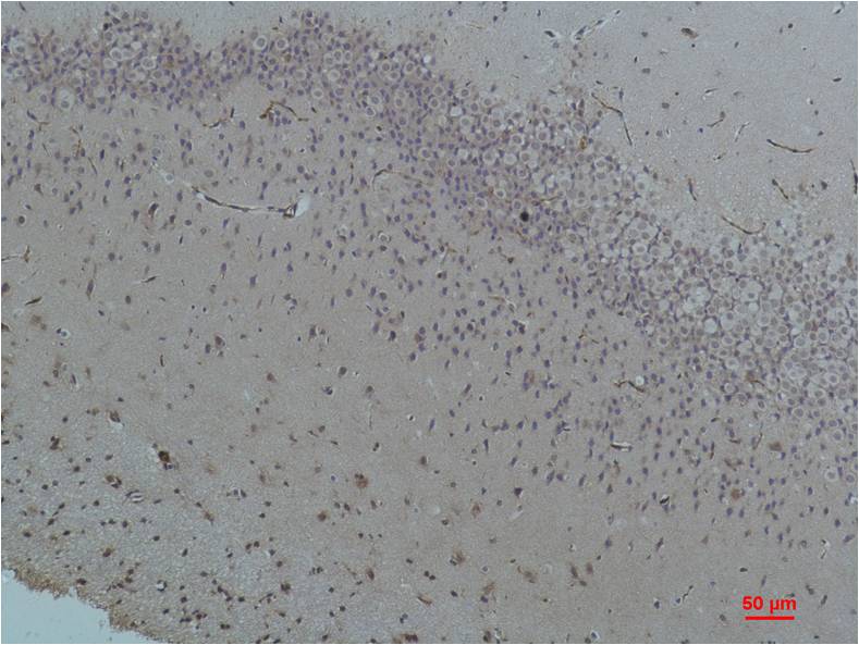 Bestrophin-1 Polyclonal Antibody (A184)