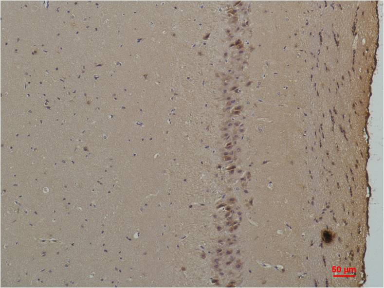 CABP Polyclonal Antibody (A189)