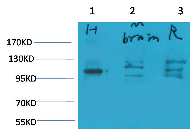 Glutamate Receptor 1 Polyclonal Antibody (A176)