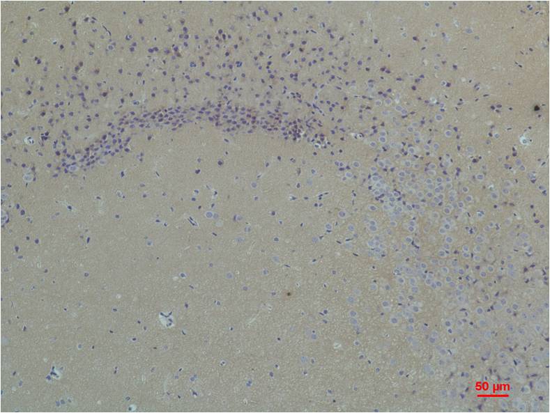 Glutamate Receptor 1 Polyclonal Antibody (A176)