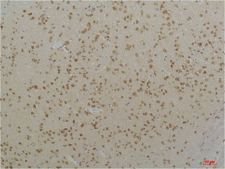 CaV1.2 Polyclonal Antibody (A201)