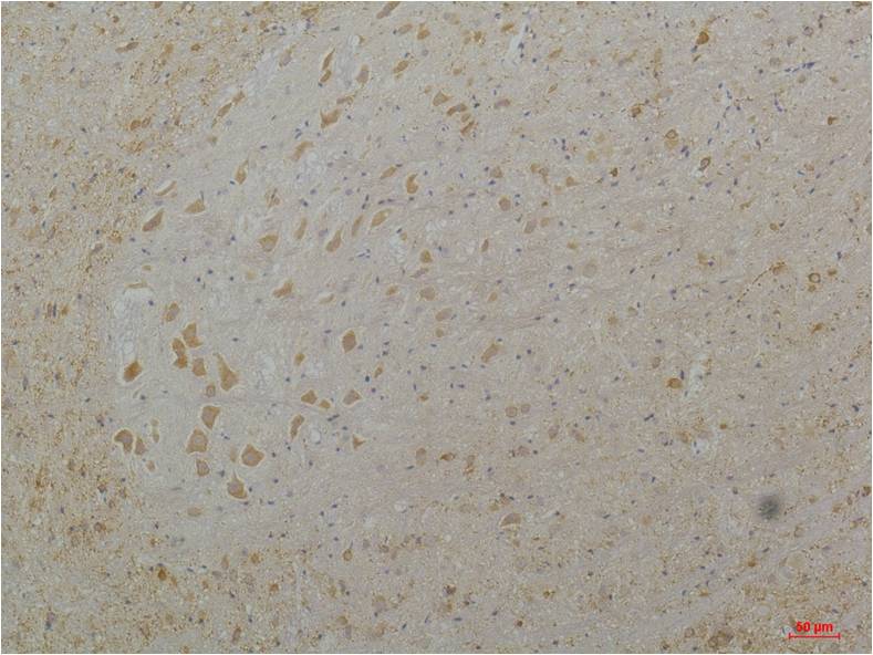 CaV1.3 Polyclonal Antibody (A202)