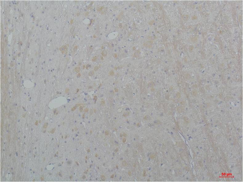 CaV2.2 Polyclonal Antibody (A205)