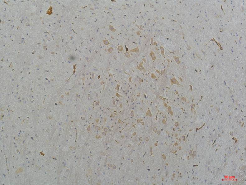 CaV2.2 Polyclonal Antibody (A205)