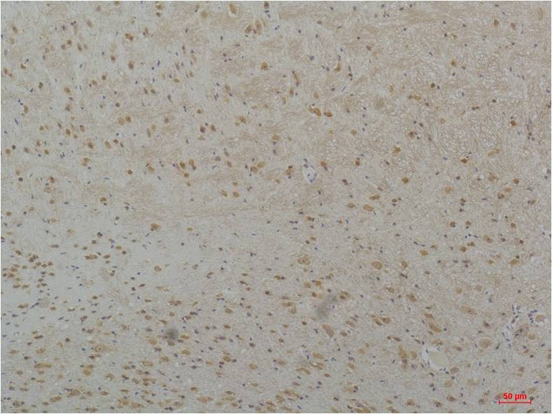 CaV3.2 Polyclonal Antibody (A208)