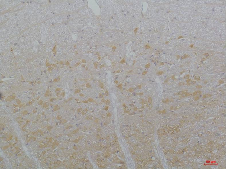 CaV3.3 Polyclonal Antibody (A209)