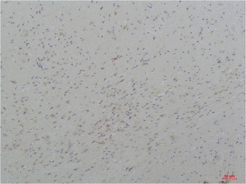 CaV3.3 Polyclonal Antibody (A209)