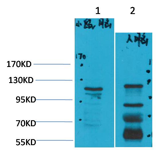 CaVAlpha2Delta3 Polyclonal Antibody (A210)
