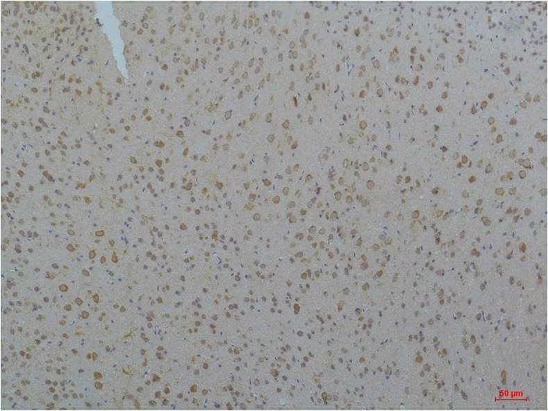 CaV pan Alpha Polyclonal Antibody (A211)