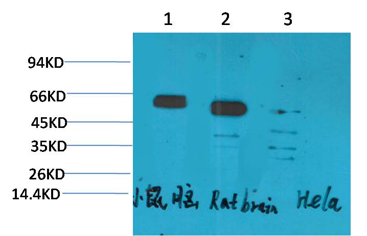 CCKBR Polyclonal Antibody (A214)