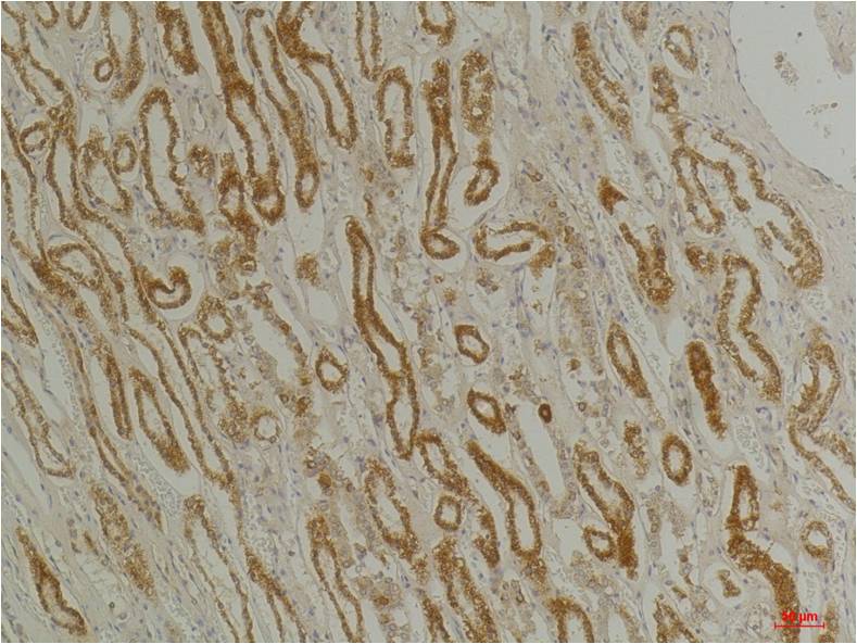 CLIC1 Polyclonal Antibody (A216)