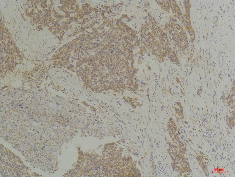 CLIC4 Polyclonal Antibody (A217)