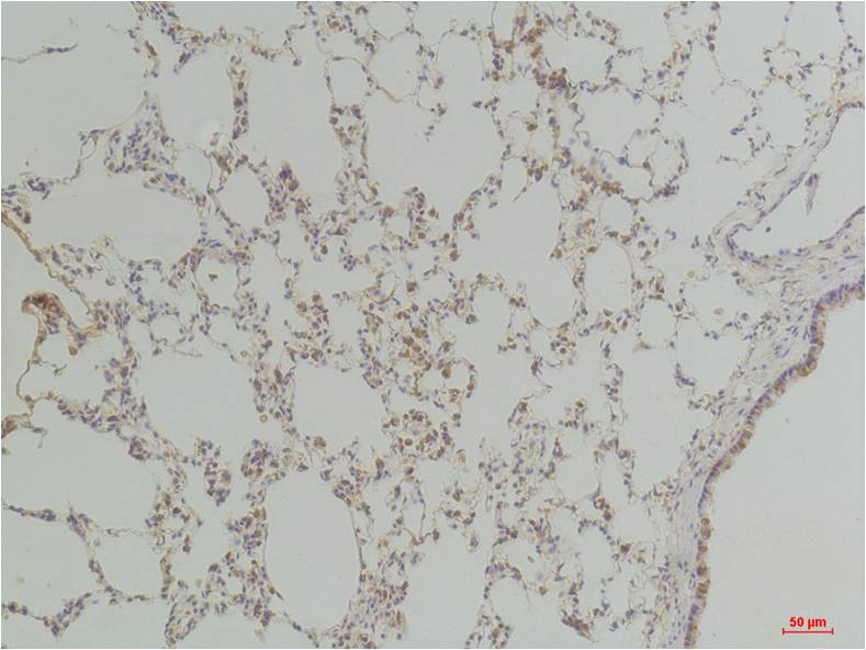 Endothelin B Receptor Polyclonal Antibody (A221)