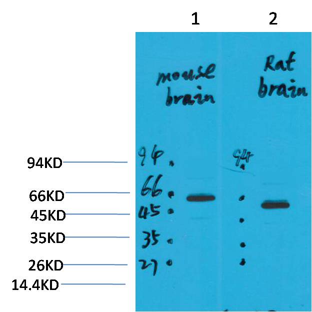 EAAT2 Polyclonal Antibody (A223)
