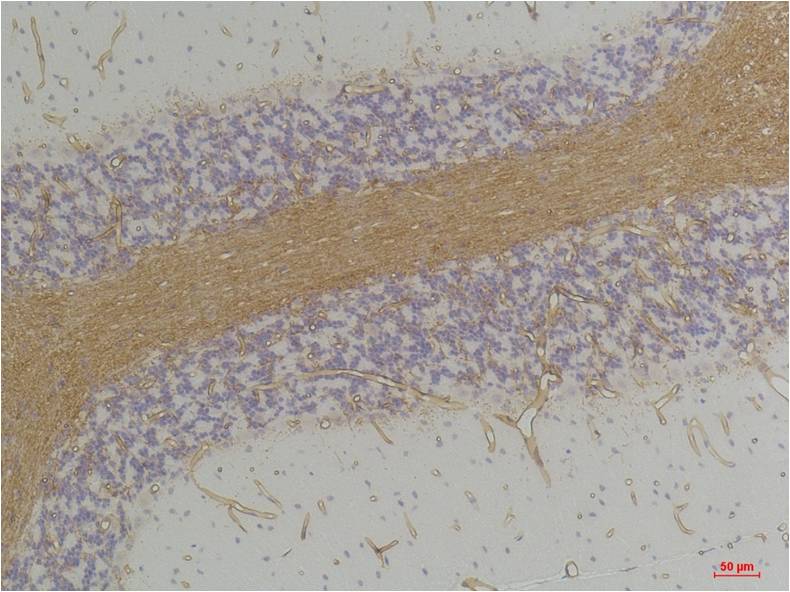 GABA A Receptor Alpha2 Polyclonal Antibody (A224)