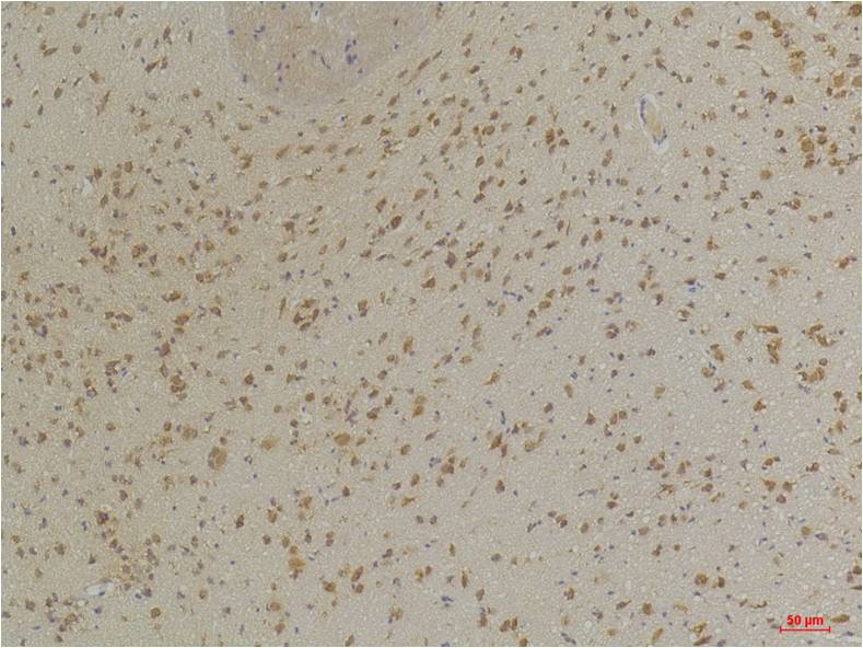 GABA A Receptor Alpha3 Polyclonal Antibody (A225)