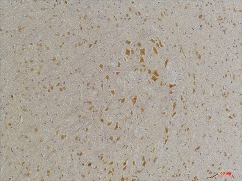 GABA A Receptor Alpha4 Polyclonal Antibody (A226)
