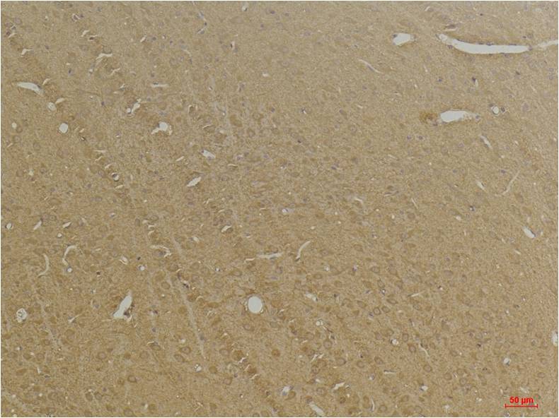 GABA B Receptor 2 Polyclonal Antibody (A228)
